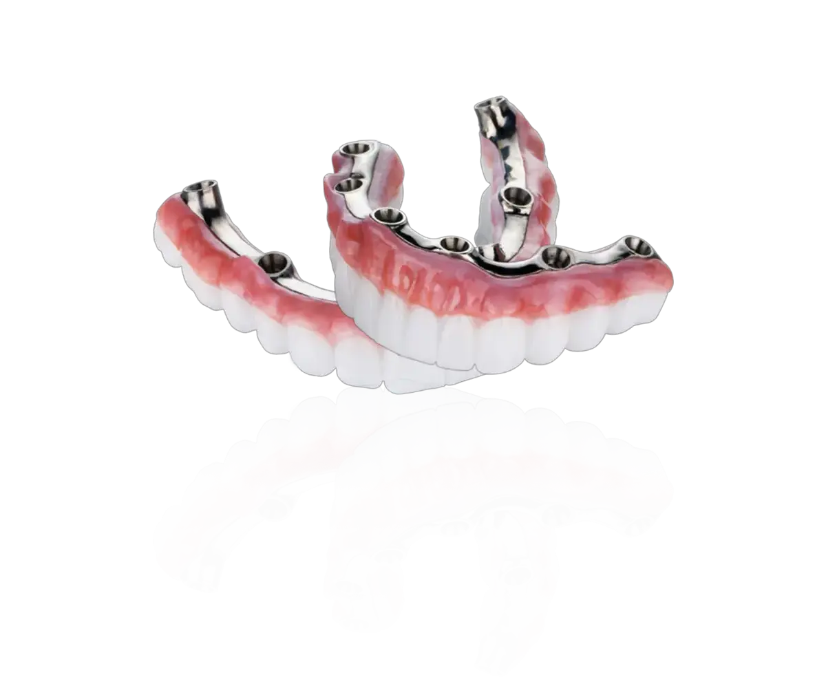 All-on-X Dental Implants